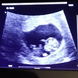 Meet your Posher, Francis